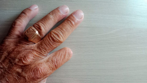 В Самаре женщине отрезали палец из-за заусенца