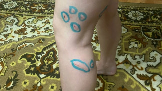 В Самаре на девушку возле метро накинулась стая бродячих собак