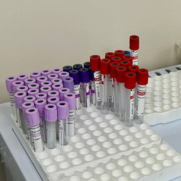 Самарцам назвали пути передачи ВИЧ в период летнего отдыха