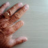 В Самаре женщине отрезали палец из-за заусенца
