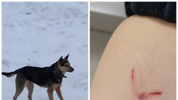Под Самарой собака вгрызлась в ногу ребенка на крыльце школы 