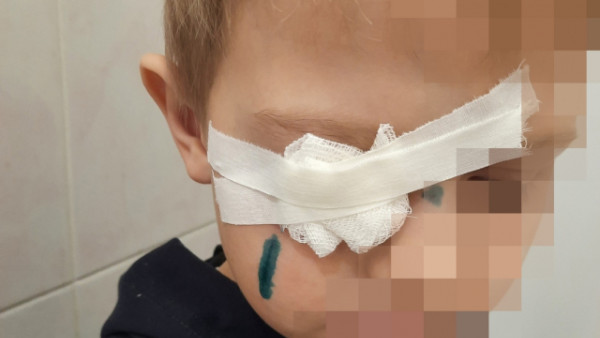 Мама в шоке: в Сызрани с ребенком произошел несчастный случай