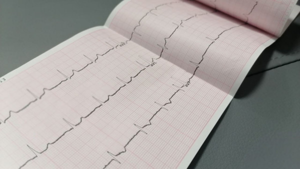 Самарские ученые научились выявлять сердечную недостаточность по голосу 