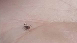 Клещ атакует: самарцам в преддверии сезона агрессии арахнидов назвали 5 секретов спасения