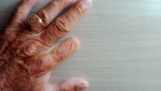 В Самаре женщине отрезали палец из-за заусенца