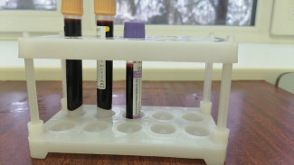 Жителей Самарской области массово проверят на содержание сахара в крови 