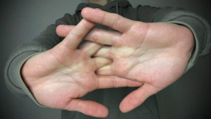 Травматологи рассказали самарцам правду о хрусте пальцами