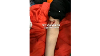 Подросток получил серьёзную травму в батутном центре Самары 