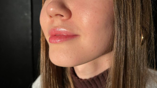 Ученые обнаружили связь между температурой разных частей лица и заболеваниями