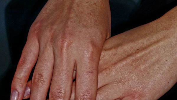 Санитарные врачи не рекомендуют самарцам ехать в Турцию из-за опасного вируса