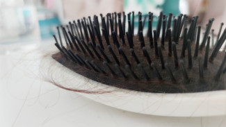 Самарцев предупредили о риске потери волос из-за сильного стресса