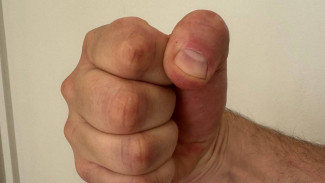 А.Бастрыкин взял на контроль дело о массовой драке подростков в Самарской области