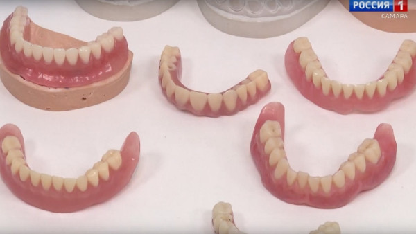 Самарцам рассказали, как вернуть красивую улыбку, столкнувшись с потерей зубов