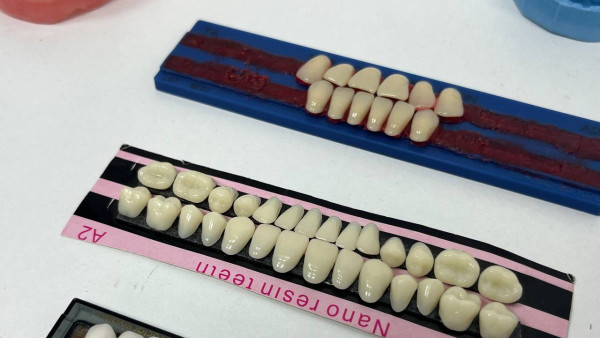 Стоматолог Е. Фаттахова рассказала самарцам, как избежать имплантации зубов