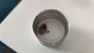 Весной 2025 года клещи атаковали почти 900 человек в Самарской области