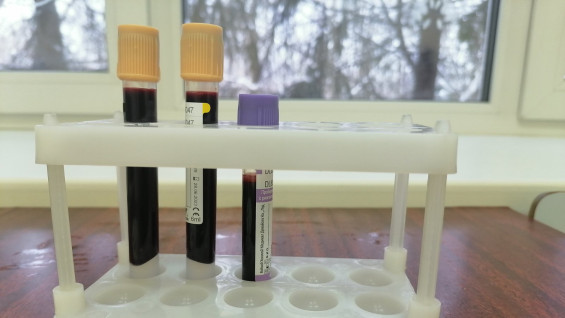 В Самарской области мигрантов начнут проверять на наличие гепатитов B, C и D 