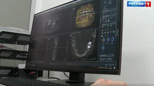 Самарцам напомнили о важности своевременного посещения стоматолога 