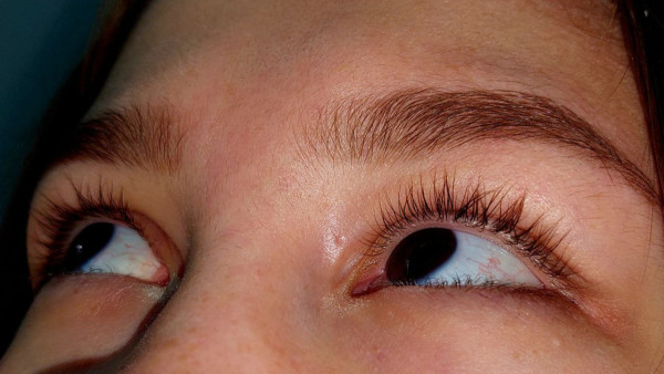 К чему дергается глаз: народные приметы для правого и левого века