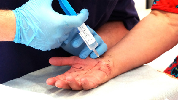 В Самаре применили уникальный титановый нож для операции на кисти руки