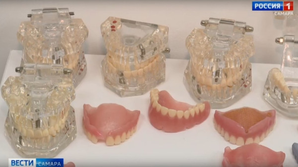 Самарцам рассказали, как после потери зубов вернуть красивую улыбку