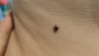 Клещи открыли сезон охоты на детей в Самарской области с приходом июньской жары