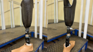 В Самаре приступили к разработке индивидуальных экзопротезов для участников СВО