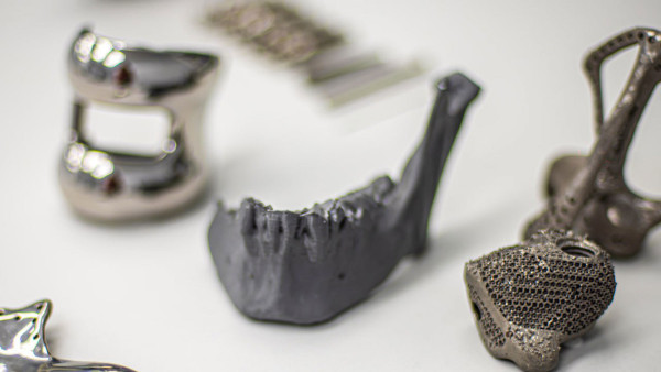 Самарские врачи по кусочкам собрали лицо женщине, пострадавшей в ДТП