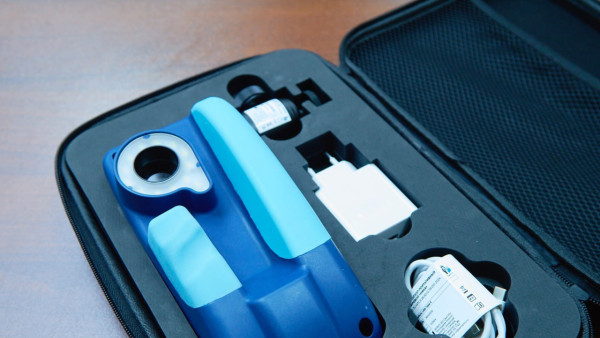 В Самаре разработали прибор для раннего выявления рака шейки матки