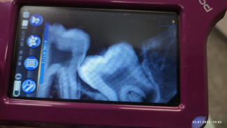 Пациентке с больным зубом в Тольятти врач предложил 2 года потерпеть