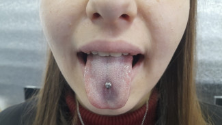 Самарцам рассказали, с каким цветом языка нужно срочно бежать к врачу