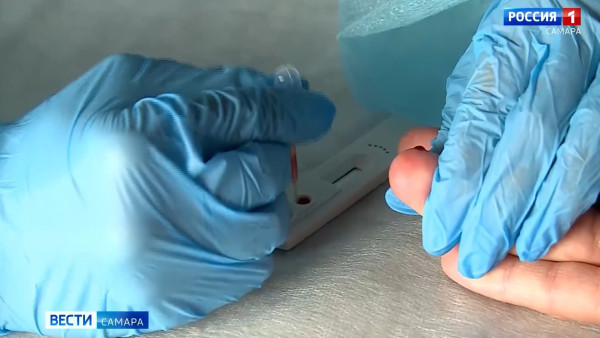 В Самарской области начал работу мобильный пункт тестирования на ВИЧ