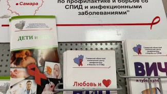 Жители Самарской области стали чаще болеть сифилисом и ВИЧ 