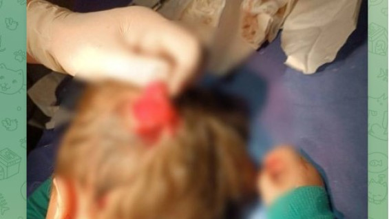 В соцсетях сообщили о нападении стаи собак на 4-летнего ребенка в Самаре