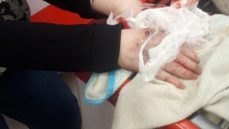 Вся в крови: собака в клочья порвала руки женщине в Тольятти