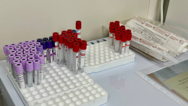 Врач О.Кит рассказал самарцам о первом симптоме рака желудка, который появляется неожиданно