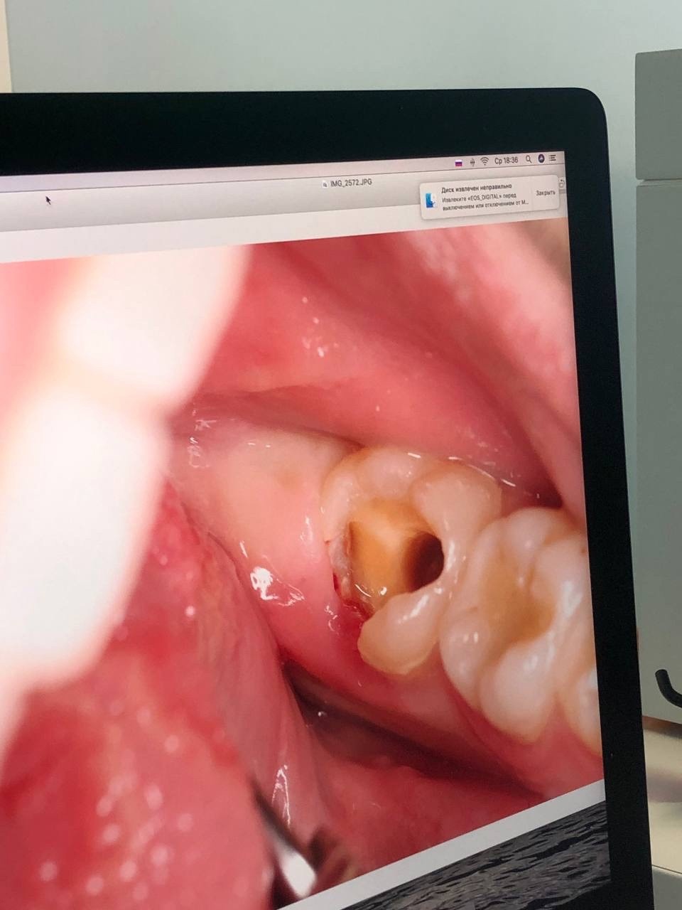 Стоматолог грубо трахает рот сидящую кресле пациентку | порно и секс фото с порно и секс звездами